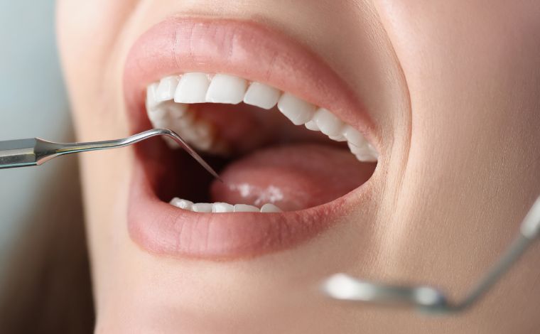 Alimentos pró-inflamatórios aumentam risco de doenças periodontais, conclui estudo