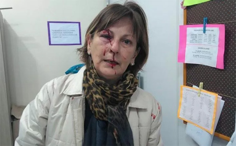 Foto publicada no Facebook por MÃ¡rcia Friggi, professora da rede pÃºblica de ensino; Ela foi agredida com vÃ¡rios socos por um aluno, dentro da escola onde trabalha, em Santa Catarina 